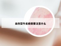 血热型牛皮癣需要注意什么