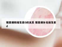银屑病和维生素D的关系 银屑病补充维生素d