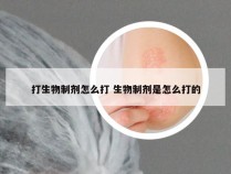 打生物制剂怎么打 生物制剂是怎么打的