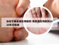 孙秋宁银屑病生物制剂 银屑病生物制剂2020年价格表