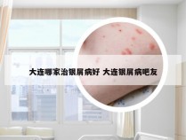 大连哪家治银屑病好 大连银屑病吧友