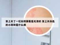 背上长了一坨白斑摸着是光滑的 背上长白色的小斑块是什么病