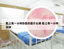 脸上有一小块白色的是什么病 脸上有一小块白块