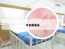 牛皮癣复杂