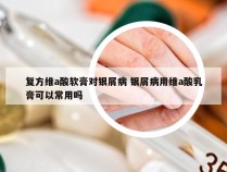 复方维a酸软膏对银屑病 银屑病用维a酸乳膏可以常用吗