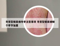 寻常型银屑病冬季注意事项 寻常型银屑病哪个季节加重