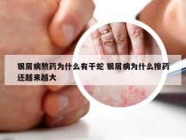 银屑病熬药为什么有干蛇 银屑病为什么擦药还越来越大