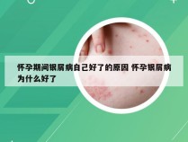 怀孕期间银屑病自己好了的原因 怀孕银屑病为什么好了