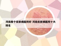 河南那个皮肤病医院好 河南皮肤病医院十大排名