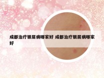 成都治疗银屑病哪家好 成都治疗银屑病哪家好