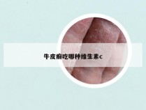 牛皮癣吃哪种维生素c