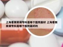 上海看银屑病专科是哪个医院最好 上海看银屑病专科是哪个医院最好的