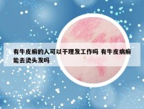 有牛皮癣的人可以干理发工作吗 有牛皮病癣能去烫头发吗