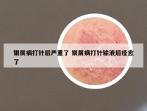 银屑病打针后严重了 银屑病打针输液后痊愈了