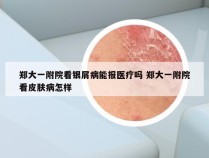 郑大一附院看银屑病能报医疗吗 郑大一附院看皮肤病怎样