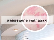 渭南整治牛皮癣广告 牛皮癣广告怎么写