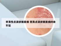 早发性点滴状银屑病 初发点滴状银屑病终身不犯