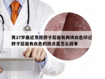 男27岁最近发现脖子后面有两块白色印记 脖子后面有白色的斑点是怎么回事