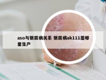 aso与银屑病关系 银屑病ak111是哪里生产