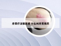 序贯疗法银屑病 什么叫序贯用药