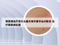 银屑病治疗有什么偏方来长春华山の稳当 治疗银屑病名医