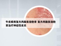 牛皮癣用复方丙酸氯倍他索 复方丙酸氯倍他索治疗神经性皮炎