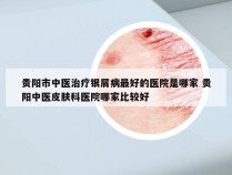 贵阳市中医治疗银屑病最好的医院是哪家 贵阳中医皮肤科医院哪家比较好