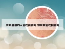 有银屑病的人能吃茴香吗 银屑病能吃回香吗