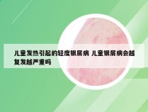 儿童发热引起的轻度银屑病 儿童银屑病会越复发越严重吗