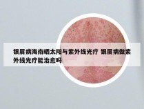 银屑病海南晒太阳与紫外线光疗 银屑病做紫外线光疗能治愈吗