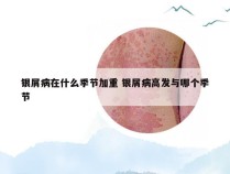 银屑病在什么季节加重 银屑病高发与哪个季节