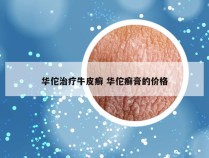华佗治疗牛皮癣 华佗癣膏的价格