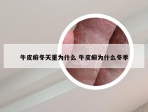 牛皮癣冬天重为什么 牛皮癣为什么冬季
