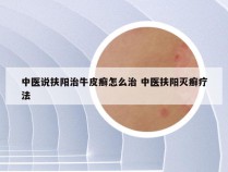 中医说扶阳治牛皮癣怎么治 中医扶阳灭癣疗法