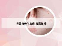 青囊秘传牛皮癣 青囊秘授
