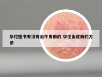 华佗医书有没有治牛皮癣的 华佗治皮癣的方法