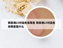 银屑病23对染色体筛查 银屑病23对染色体筛查是什么