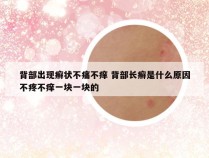 背部出现癣状不痛不痒 背部长癣是什么原因不疼不痒一块一块的