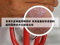 青海牛皮癣医院哪家好 青海省最好的皮肤科医院是哪家方位就青北找