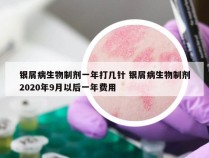银屑病生物制剂一年打几针 银屑病生物制剂2020年9月以后一年费用