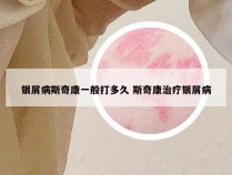 银屑病斯奇康一般打多久 斯奇康治疗银屑病