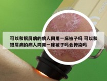 可以和银屑病的病人同用一床被子吗 可以和银屑病的病人同用一床被子吗会传染吗