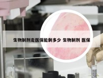 生物制剂走医保能剩多少 生物制剂 医保