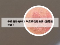 牛皮癣补充B12 牛皮癣吃维生素b还是维生素c