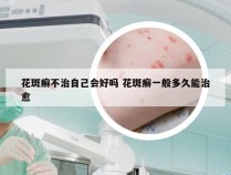 花斑癣不治自己会好吗 花斑癣一般多久能治愈