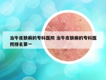 治牛皮肤癣的专科医院 治牛皮肤癣的专科医院排名第一