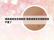 银屑病用完生物制剂 银屑病用完生物制剂更严重了