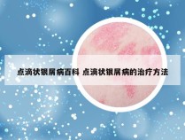 点滴状银屑病百科 点滴状银屑病的治疗方法