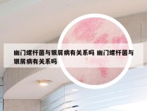幽门螺杆菌与银屑病有关系吗 幽门螺杆菌与银屑病有关系吗