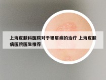 上海皮肤科医院对于银屑病的治疗 上海皮肤病医院医生推荐